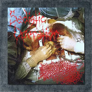 Ingested Lobotomized Remains Back Patch, Ingested Lobotomized Remains – Sadistic Operation Big Back Patch